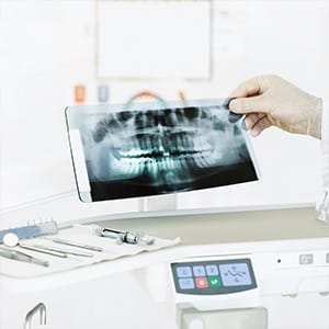 X-ray Taylor Orthodontics in Tustin and Ladera Ranch, CA